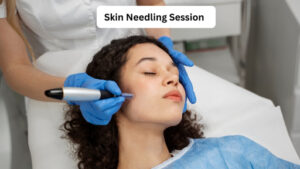 Skin Needling